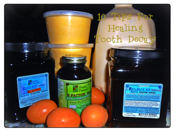 10 Tips for Healing Tooth Decay from Nourishing Time post image