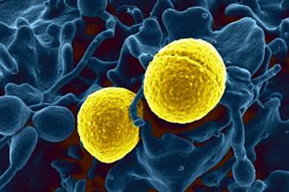 Post image for Antibiotic Resistant Bacteria on the Rise — What To Do
