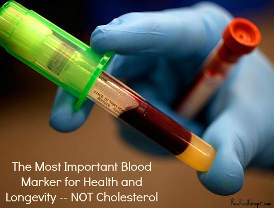 The Most Important Blood Marker for Health and Longevity — Not Cholesterol! post image