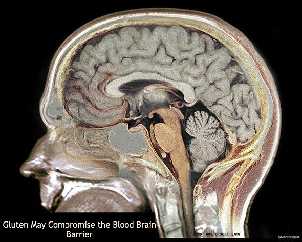 Gluten May Compromise the Blood Brain Barrier post image