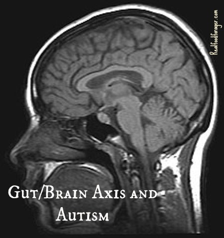 New Study: The Gut/Brain Axis and Autism post image