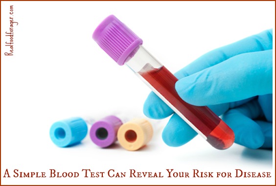 A Simple Blood Test Can Reveal Your Risk for Disease post image