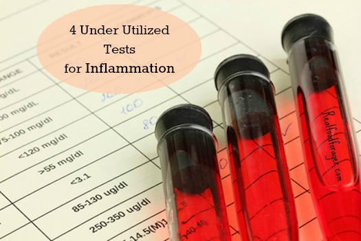 4 Under Utilized Tests for Inflammation in the Body post image