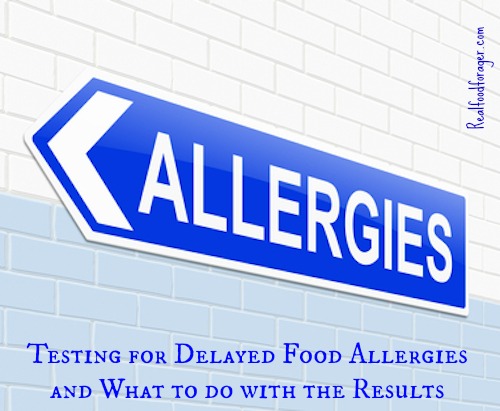 Post image for Testing for Delayed Food Allergies and What to do with the Results