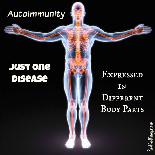 Autoimmunity: Just One Disease Expressed in Different Body Parts post image