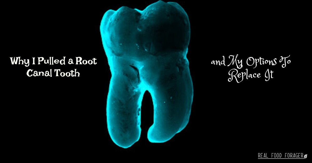 root canal, root canal tooth