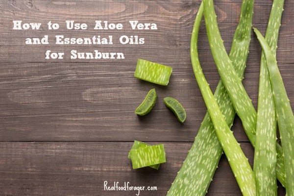 How to Use Aloe Vera and Essential Oils for Sunburn post image