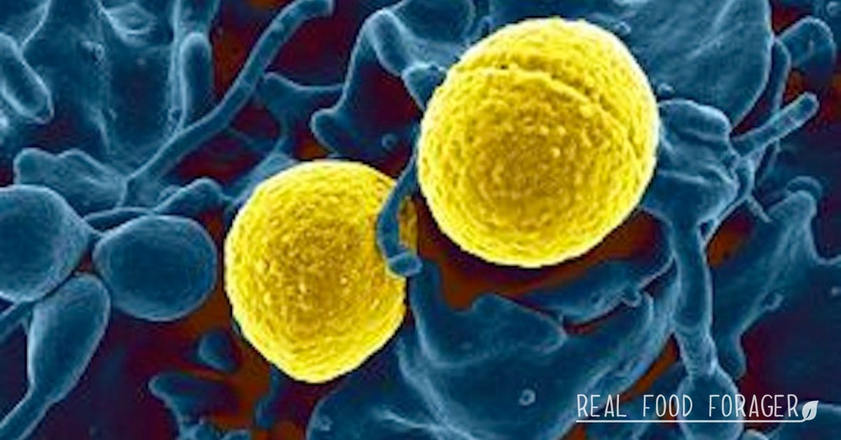Antibiotic Resistant Bacteria, Bacillus Subtilis